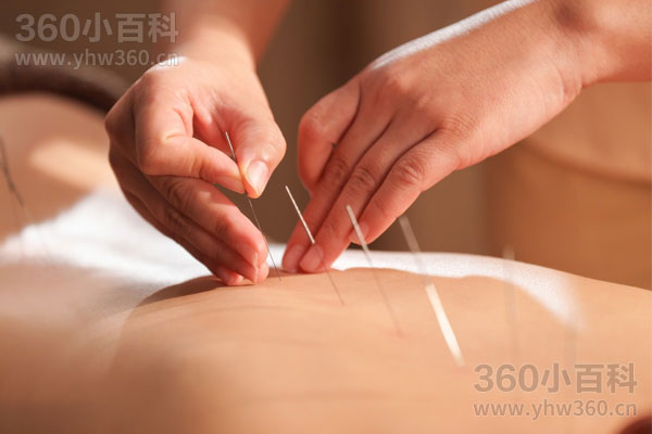 针灸的功效与作用｜中医传统疗法的原理、适用范围与注意事项